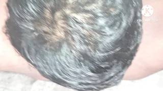 Boyfriend Removed His Girlfriend Hairy Pussy To A Clean Pussy
